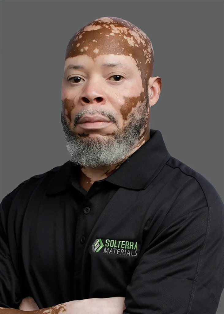 A man with vitiligo and a gray beard wearing a black Solterra Materials polo shirt stands against a plain gray background with arms crossed.